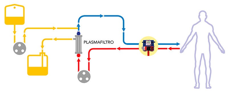 Circuiti-Plasma-Exchange